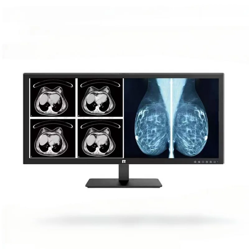 34-tommer 5MP Medical Diagnostic Monitor