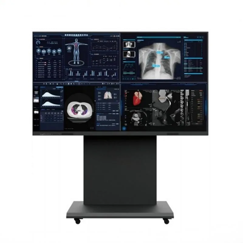 86-tommer 8MP Medical Consultation Monitor Terminal